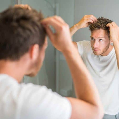 prevenção de queda de cabelo em homens jovens