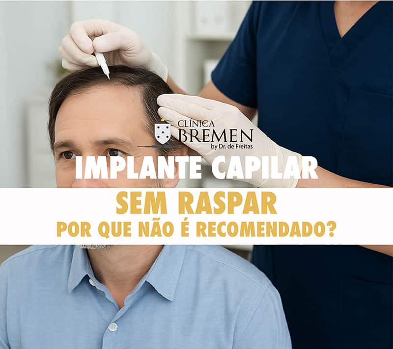 Implante capilar sem raspar